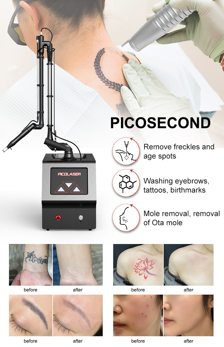Non invasive Laser Skin Care12